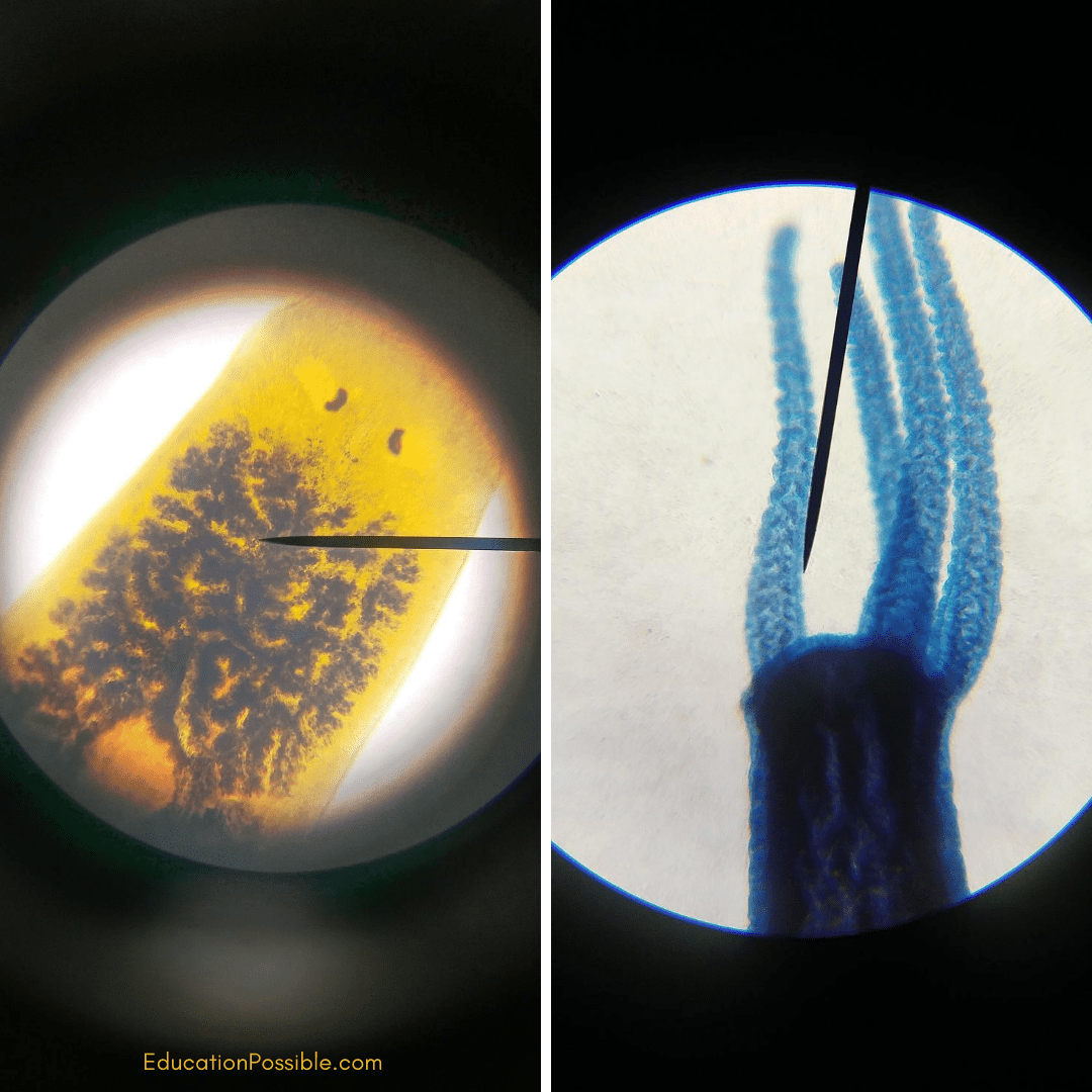 Two images side by side - prepared slides from high school biology class magnified in a microscope. Yellow image with brown dots in a cluster and a blue specimen with four short tentacles.